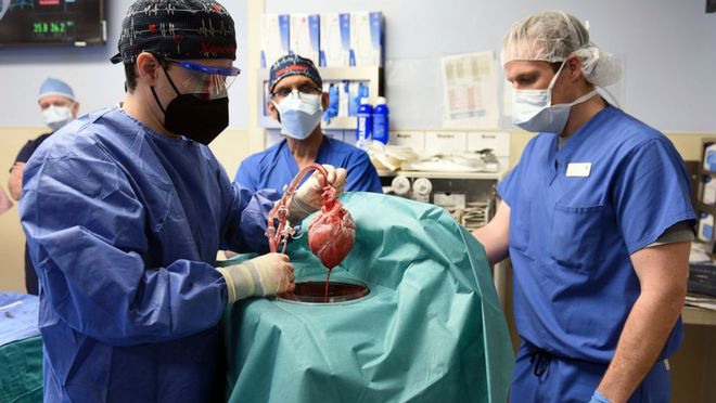 国外医生成功将猪心脏，移植到人类患者体内！术后病人情况良好